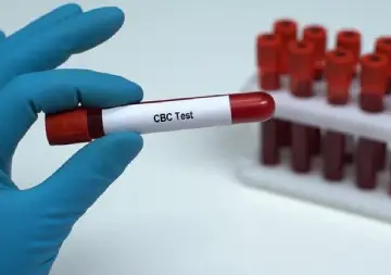 آزمایش خون کامل (CBC