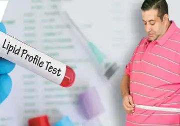 پروفایل چربی کلسترول